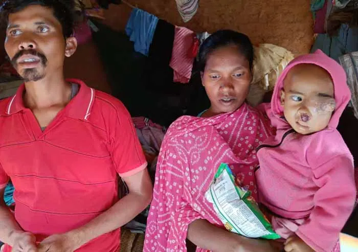 आंख के कैंसर से पीड़ित हैं सोनाबाबू, आदिवासी क्रांति सेना ने दिया मदद का आश्वासन