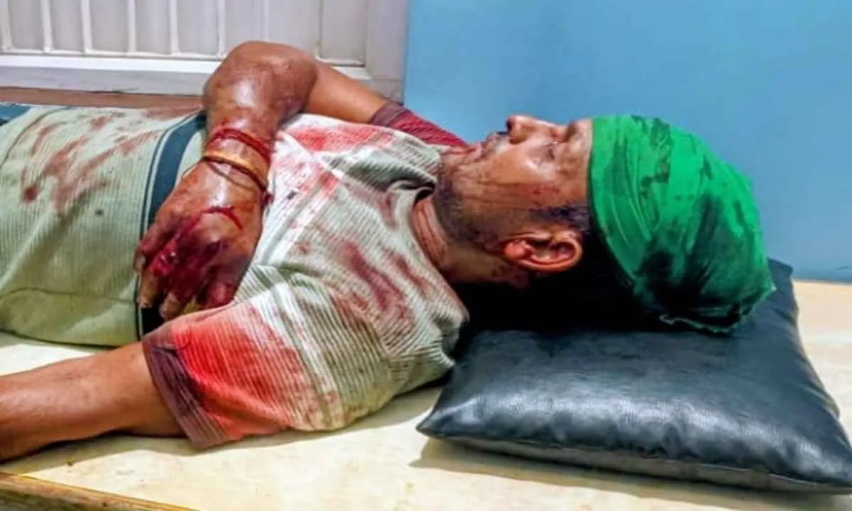 Koderma News: युवक को कुल्हाड़ी से मारकर किया घायल, एक हिरासत में