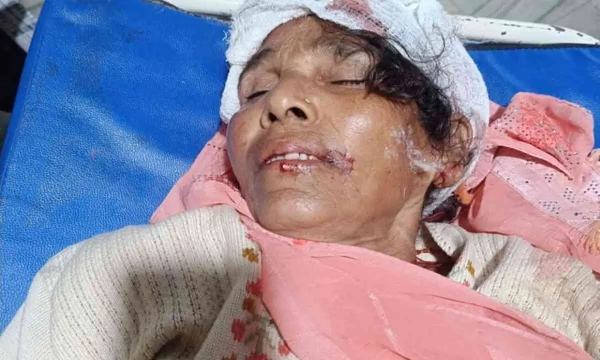 Palamu News : ईंट लदे ट्रैक्टर ने बाइक को मारी टक्कर, एक ही परिवार के तीन लोग गंभीर