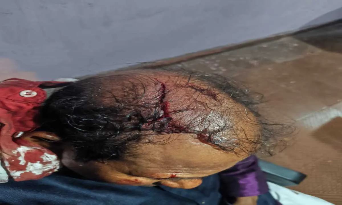 Dhanbad News: जमीन विवाद में बहूभोज बना रणक्षेत्र, 11 पर जानलेवा हमले की शिकायत