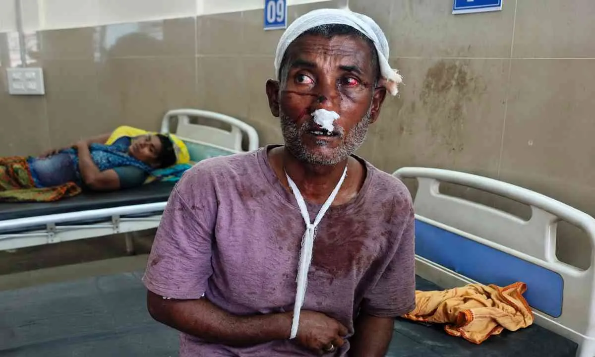 Palamu News: हुसैनाबाद में मामूली विवाद ने लिया हिंसक रूप, घर में घुसकर हमला