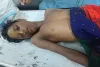 Koderma News: राजाबर के कुसहनियां गांव में सर्पदंश से 13 वर्षीय मासूम की दर्दनाक मौत