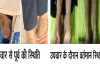 नामुमकिन हुआ मुमकिन, ‘लाइलाज’ समझी जा रही बीमारी का एम्स रायपुर में सफल उपचार