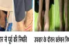 नामुमकिन हुआ मुमकिन, ‘लाइलाज’ समझी जा रही बीमारी का एम्स रायपुर में सफल उपचार