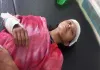Koderma News: अंबाबाद में घर में घुसकर महिला पर कुल्हाड़ी से वार, छह नामजद पर केस