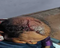 Dhanbad News: जमीन विवाद में बहूभोज बना रणक्षेत्र, 11 पर जानलेवा हमले की शिकायत