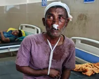 Palamu News: हुसैनाबाद में मामूली विवाद ने लिया हिंसक रूप, घर में घुसकर हमला