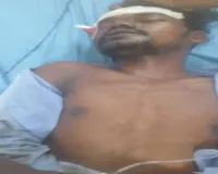 सड़क किनारे लहूलुहान पड़ा था अज्ञात शख्स, पाकुड़िया पुलिस ने बचाई जान