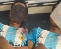 पाकुड़िया CHC में भर्ती अज्ञात घायल बच्चे की पहचान नहीं, परिजनों की तलाश में जुटा अस्पताल प्रशासन