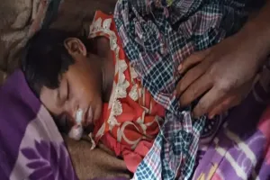 Koderma News: सर्पदंश से नाबालिग बच्ची की मौत