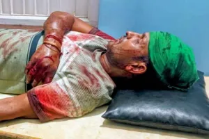 Koderma News: युवक को कुल्हाड़ी से मारकर किया घायल, एक हिरासत में