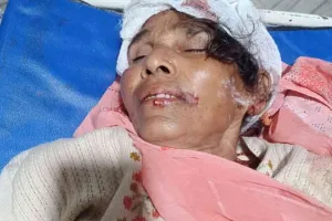 Palamu News : ईंट लदे ट्रैक्टर ने बाइक को मारी टक्कर, एक ही परिवार के तीन लोग गंभीर