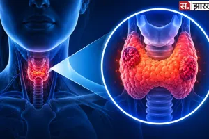 World Thyroid Day 2026: महिला या पुरुष, किसे ज्यादा होता है थायरॉइड? जानें लक्षण, कारण और बचाव