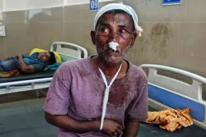 Palamu News: हुसैनाबाद में मामूली विवाद ने लिया हिंसक रूप, घर में घुसकर हमला