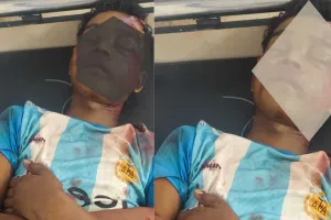 पाकुड़िया CHC में भर्ती अज्ञात घायल बच्चे की पहचान नहीं, परिजनों की तलाश में जुटा अस्पताल प्रशासन