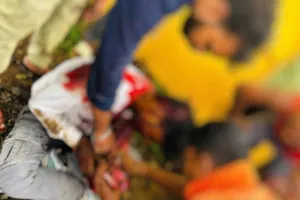 Hazaribagh News: कटकमसांडी मार्ग पर दो बाइकों की सीधी भिड़ंत, हादसे में तीन लोग गंभीर घायल